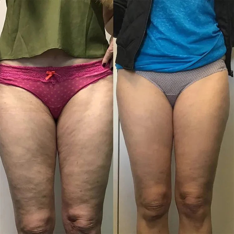 DermaSculpt™